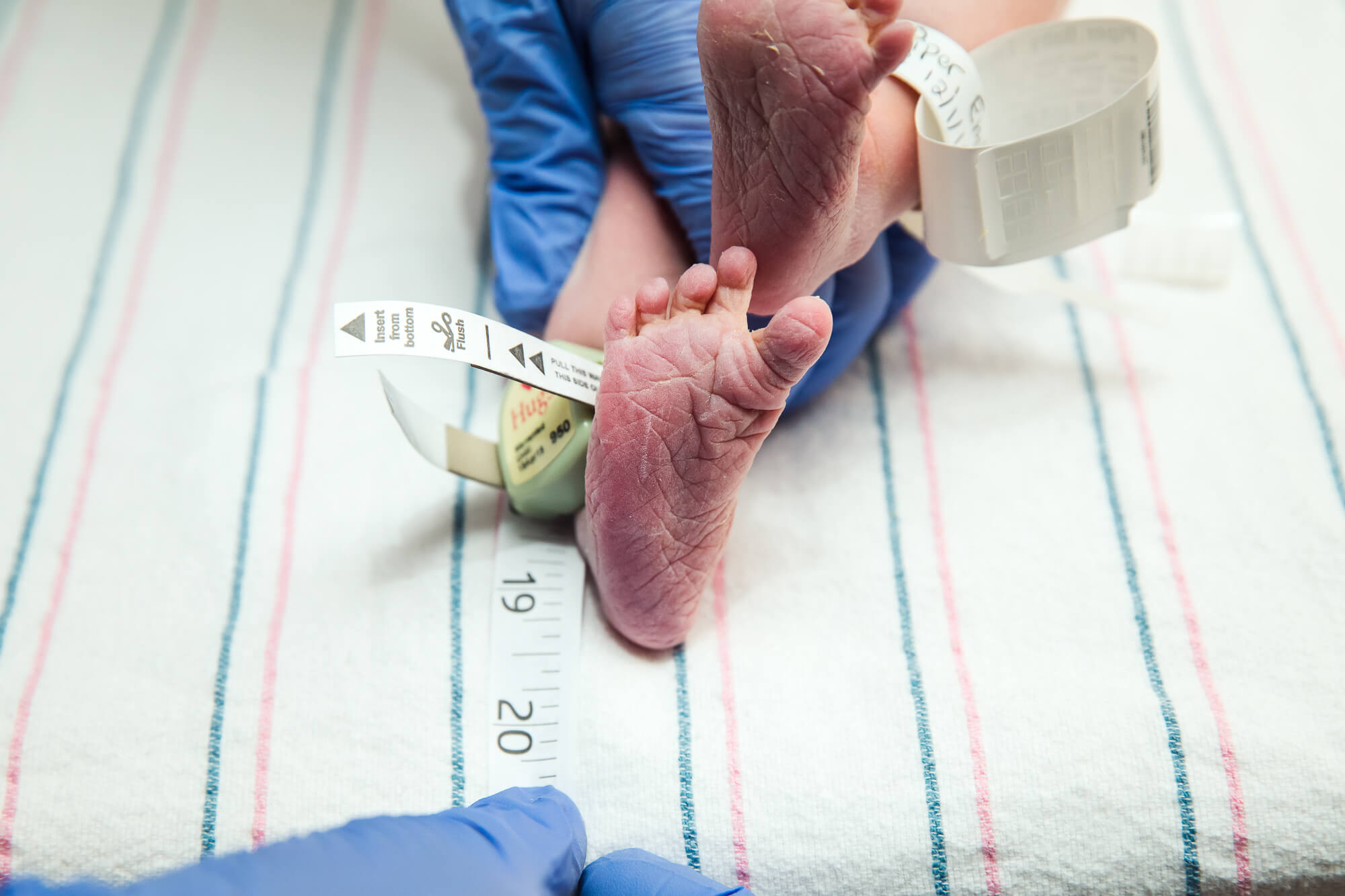 Newborn baby's toes splayed as its legs are held by two blue-gloved hands on a hospital baby blanket, an ID tag on the baby's left ankle